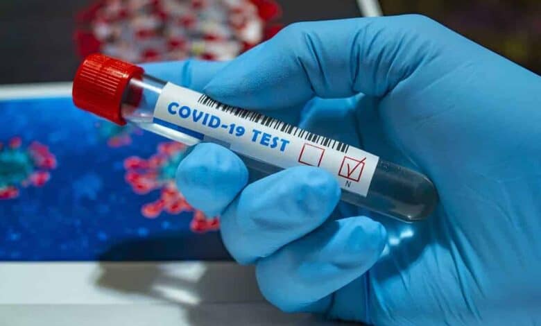 Sikkim Covid 19 : 23 New with 13.9% PR becomes highest in 24 hour
