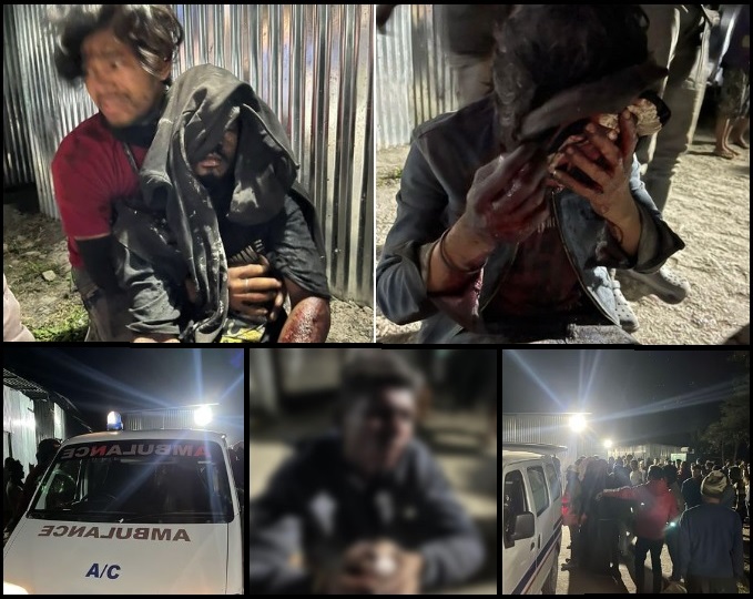 Explosion In NHPC Barrack Leaves Four Seriously Injured