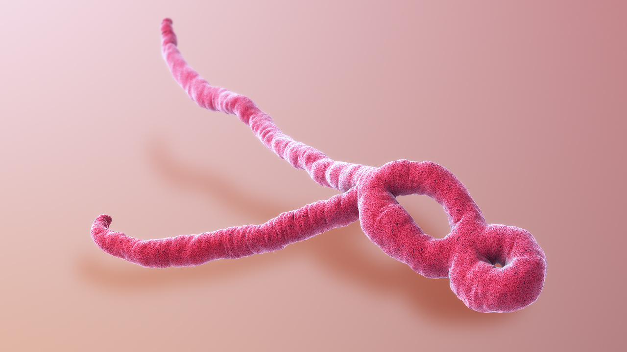 Everything You Must Know About Ebola